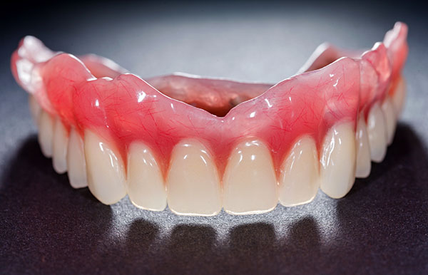 illustrative image of dental bridges in Mississauga